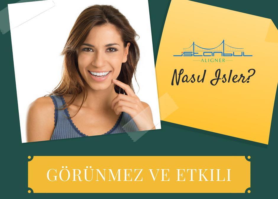 Baştan Sona İstanbul Aligner Uygulaması